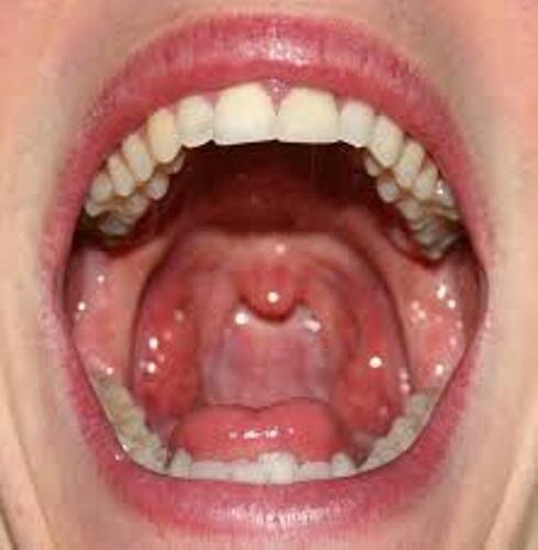 Inside Of Mouth 60