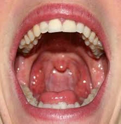 Mouth Inside